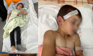 В резултат на военната агресия на Азербайджан: Двама загинали ( включително дете), десетки ранени