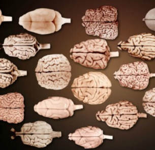Мозъкът като смачкана хартия