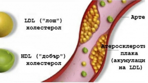 Така се понижава холестерол без лекари и лекарства