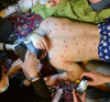 Иранските сили стрелят по лицата и гениталиите на протестиращи жени