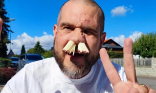 Необичаен рекорд на Гинес: Мъж напъха 81 клечки в носа си заради децата си